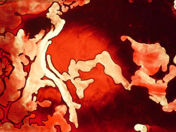 Liquid File blood Liquid File blood
